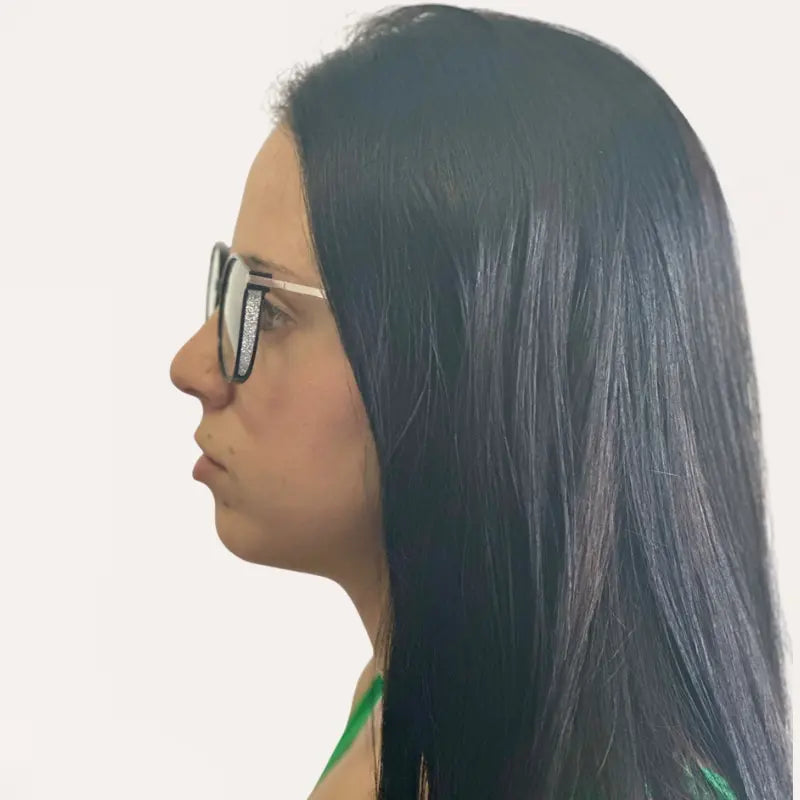 Crystal Elite Vision Multifocal Glasses